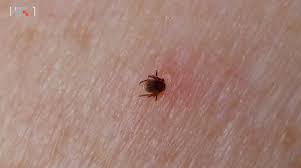 Мере личне заштите од убода крпеља