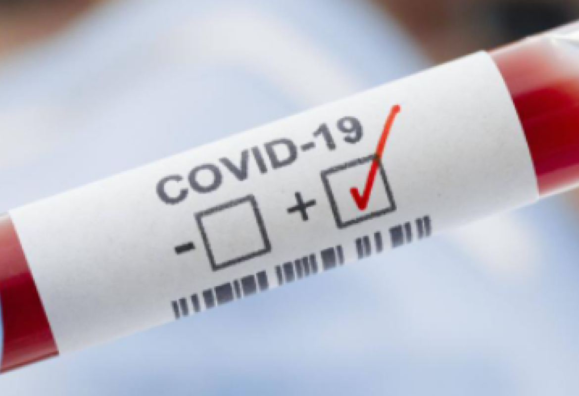 COVID-19, илустрација 